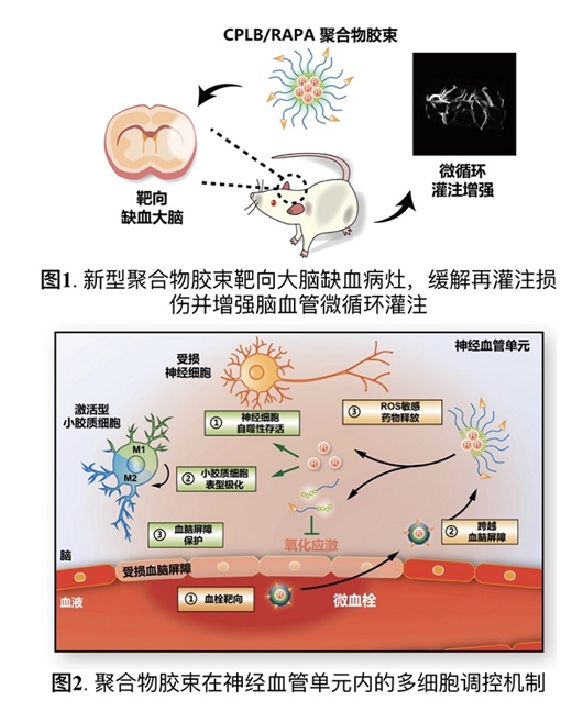 科學家構建靶向治療缺血型腦卒中膠束遞藥系統(tǒng)-肽度TIMEDOO