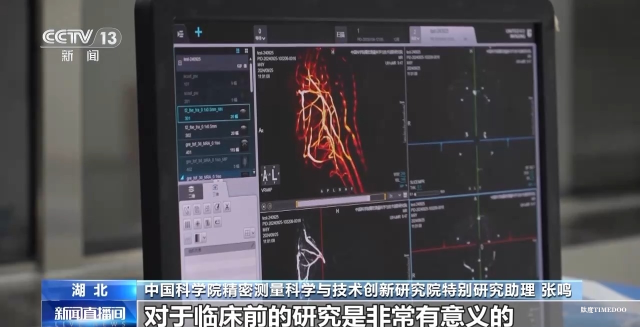 中國科學(xué)院團隊成功突破“多核”磁共振成像技術(shù)-肽度TIMEDOO